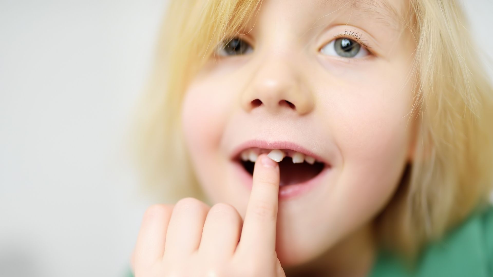 Pediatric Dentistry Brampton - Dentist In Brampton